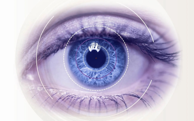 ANSOMATIC: monitoring and analysis